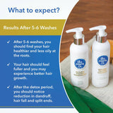 The Moms Co Anti Hair Fall 3-Step Protein Kit image 6