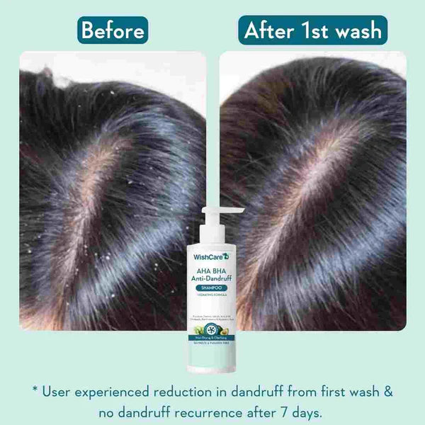 WishCare Hydrating AHA BHA Anti Dandruff Shampoo 250ml image 3