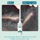 WishCare Hydrating AHA BHA Anti Dandruff Shampoo 250ml image 4