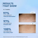Plum 10% Niacinamide Face Serum For Clear, Bright Skin Fades Blemishes 10 ml image 5