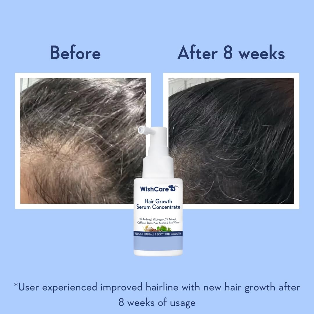WishCare Hair Growth Serum Concentrate -30ml image 3