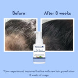 WishCare Hair Growth Serum Concentrate -30ml image 3