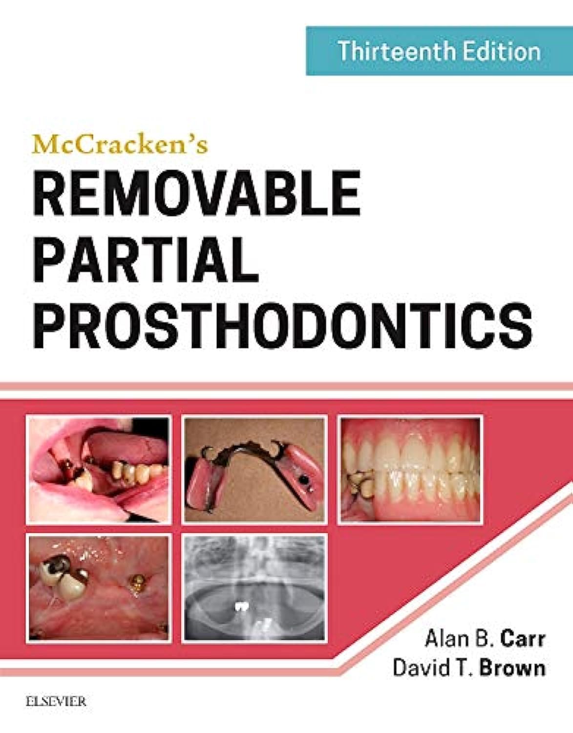 Book cover of McCracken's Removable Partial Prosthodontics 13th Edition