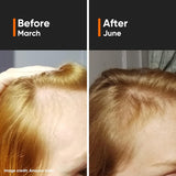 Minimalist Hair Growth Serum With 3% Redensyl, 3% Anagain, 3% Procapil- 30 ml image 5
