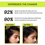 Alps-Goodness Rosemary Water Spray for Hair Growth- 200ml image 4