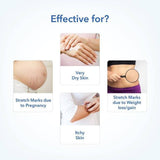 The Moms Co Natural Stretch Oil image 4