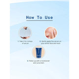 BeBodywise Acne Marks Reduction Face Serum -30 ml image 3
