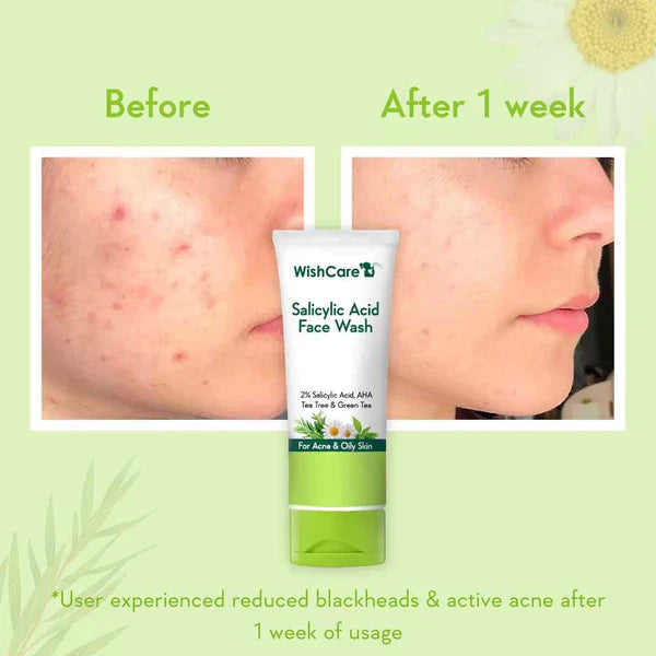 2% Salicylic Acid Face Wash - 100ml image 4