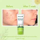 2% Salicylic Acid Face Wash - 100ml image 4